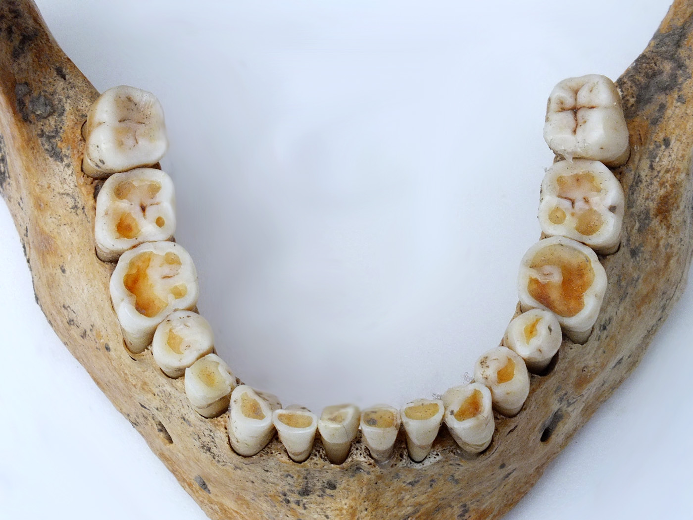 A középkori táplálkozás tükre, a fogak